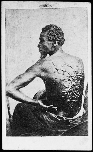 M'Pherson and Oliver, [The Scourged Back/Gordon] ([Philadelphia: McAllister & Brother,]  ca.1863). Albumen on carte de visite mount.